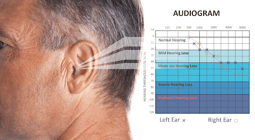 The odds are stacked against us when it comes to hearing loss